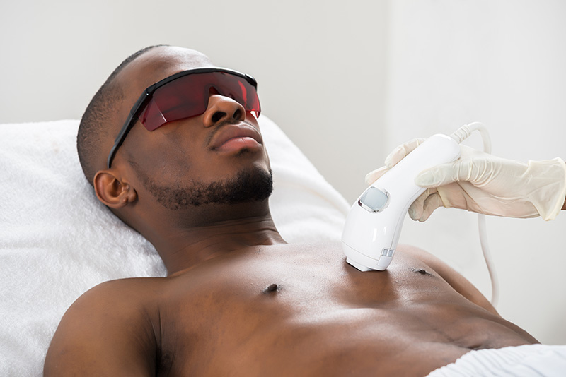 Epilation homme Guadeloupe